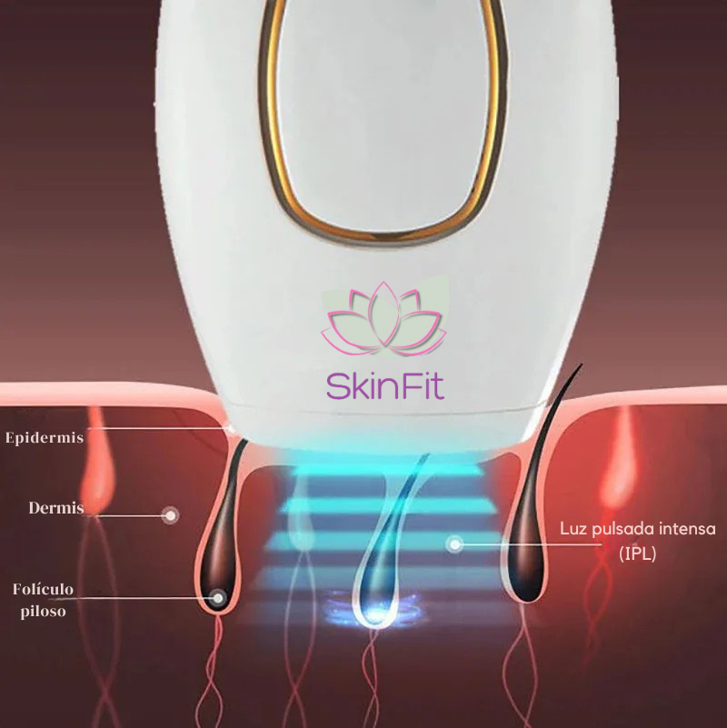 LumaSkin™ IPL – Depilación definitiva sin dolor