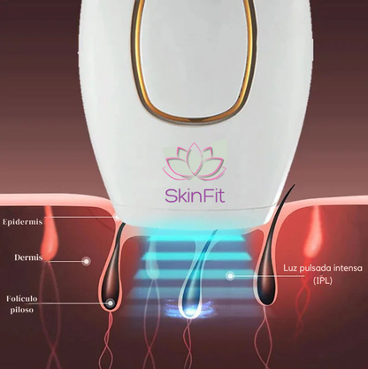 LumaSkin™ IPL – Depilación definitiva sin dolor